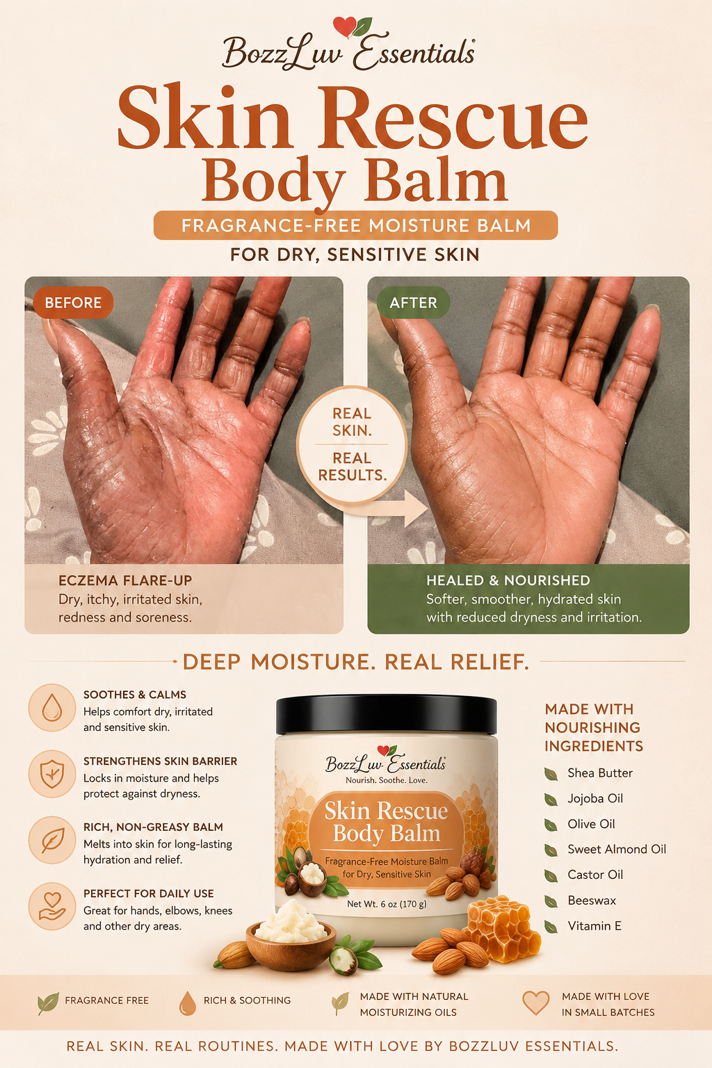 BozzLuv Skin Rescue body balm product photo for dry and sensitive skin.